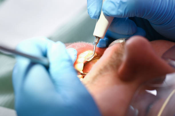 Best Pediatric Emergency Dentist in Bellevue, ID